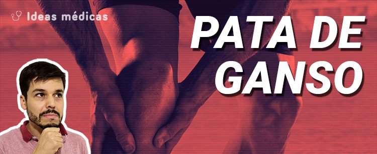 ¿Qué es la pata de ganso? ¿Por qué puede doler? ¿Cómo se diagnostica y cómo se trata?